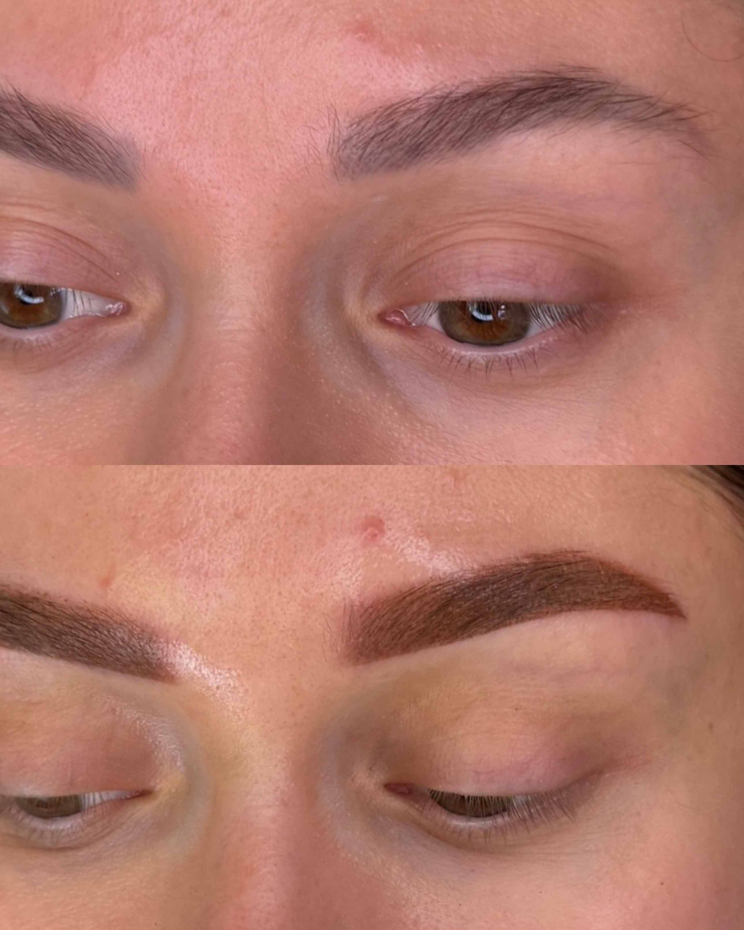 Corrección de Cejas