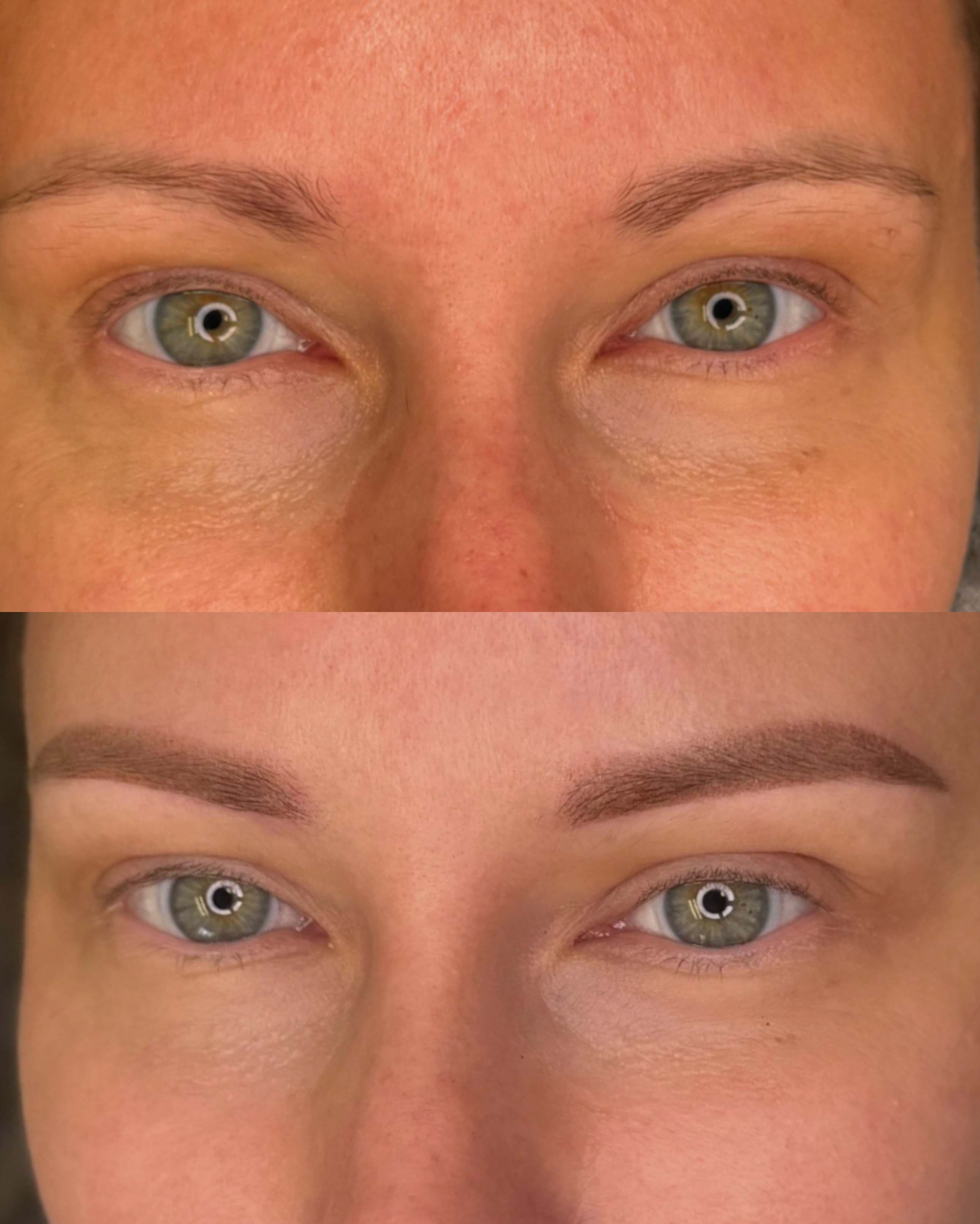 Corrección de Cejas