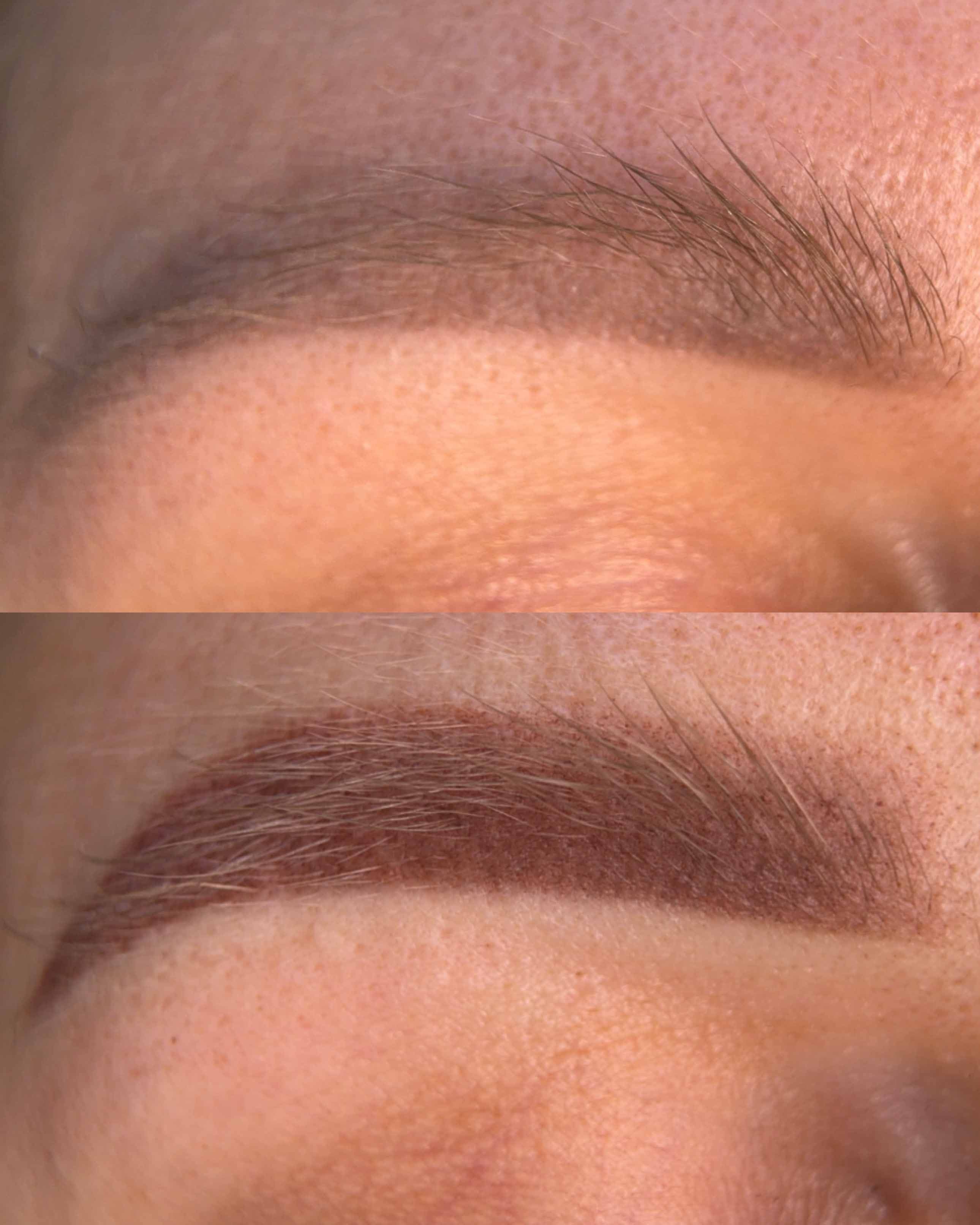 Corrección de Cejas